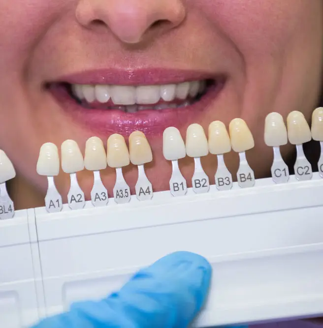 A woman receiving teeth whitening services at Kraja and Sidhu Dental
